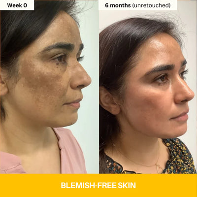 Kojic Acid Brightening Body Wash