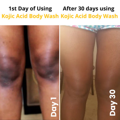 Kojic Acid Brightening Body Wash