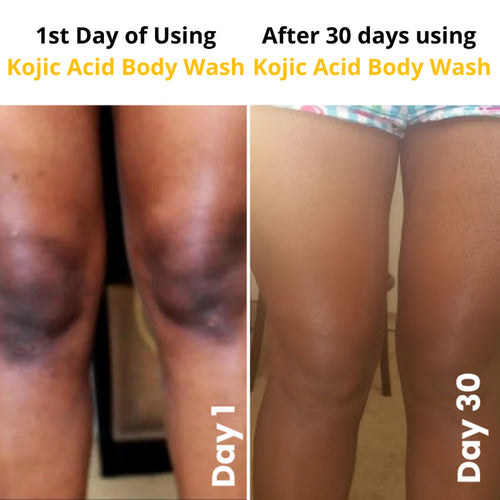 Kojic Acid Brightening Body Wash