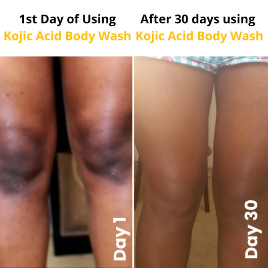 Kojic Acid Brightening Body Wash